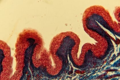 Hautkrebs Screening
