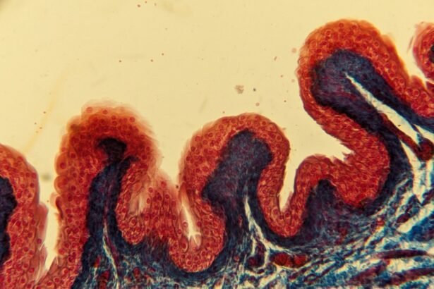 Hautkrebs Screening