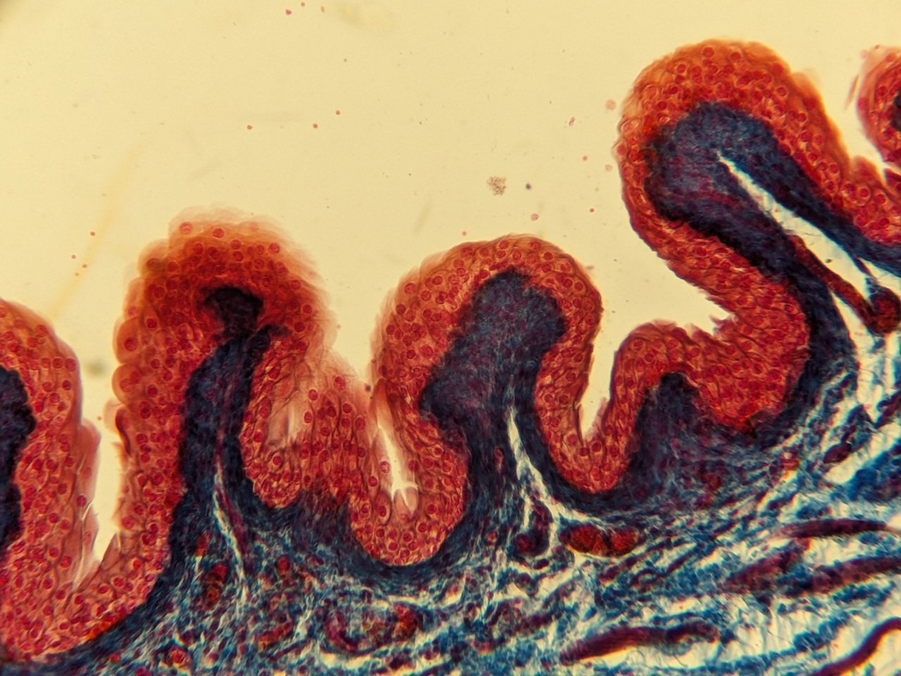 Hautkrebs Screening